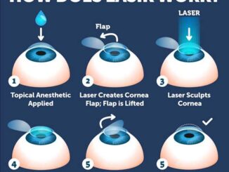 Explaining The Different Types Of Lasik Eye Surgery And Their Costs