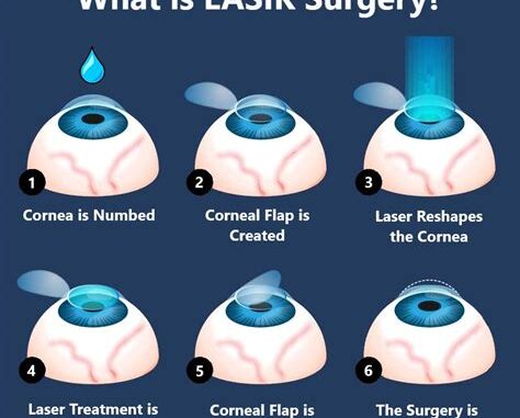 Patient Experiences: The Real Cost Of Lasik Eye Surgery