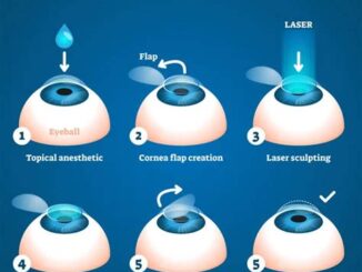 The Future Of Lasik Eye Surgery Costs: Trends And Predictions